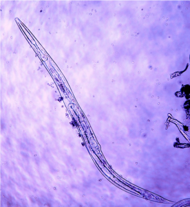 Micrograph of nematode.