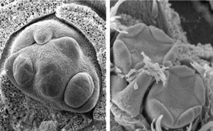 Scanning electron micrograph showing pistil differentiation.