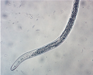 Micrograph of a root lesions nematode.